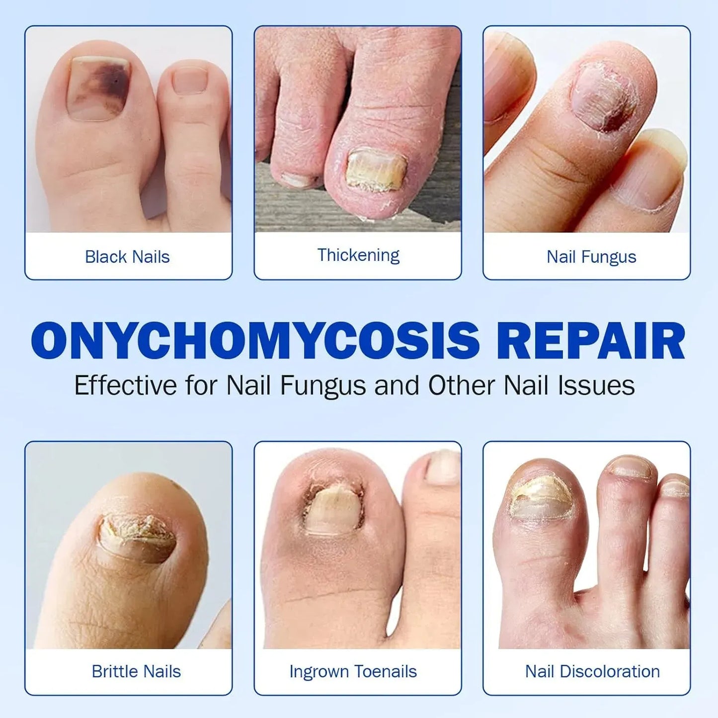 Fungal Nail Treatment Patches