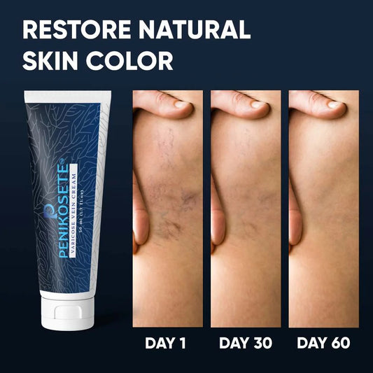 Penikosete,Ashwagandha Cream For Advanced Vein Care & Treatment.