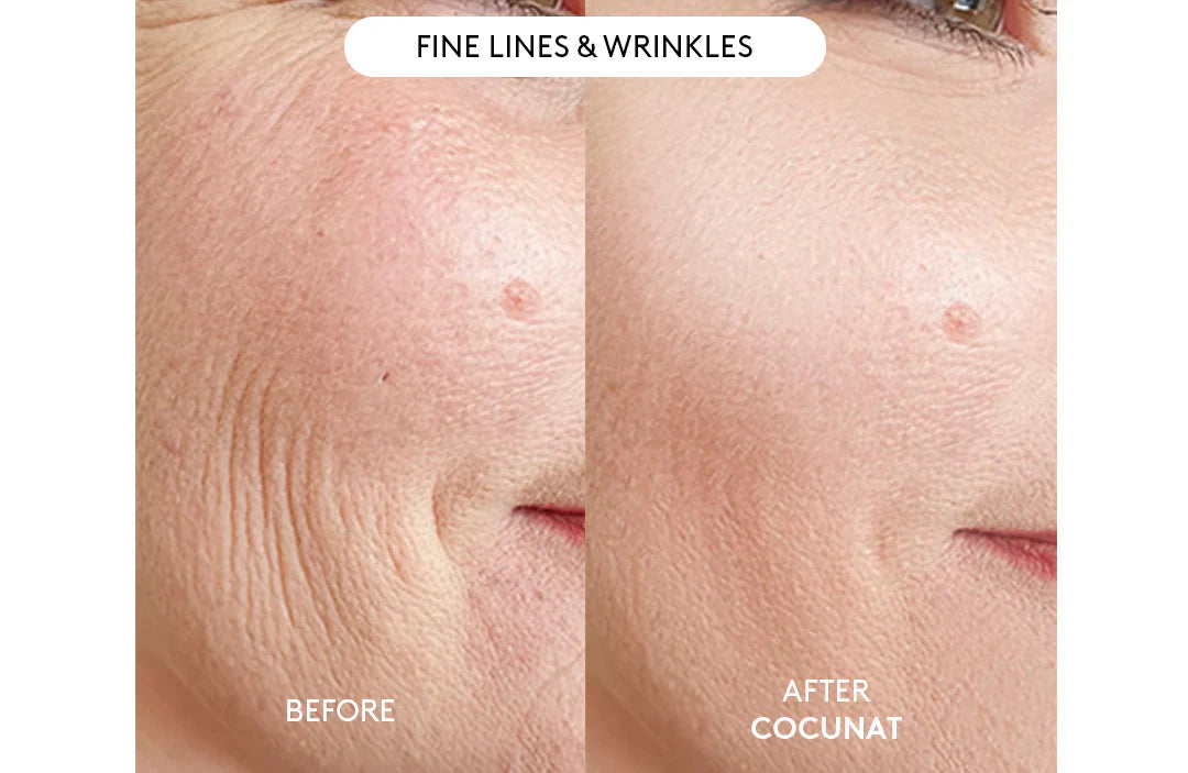 Clinical Beauty Filler